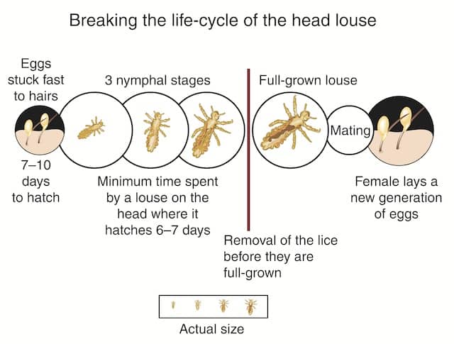 Head Lice Life Cycle The Good Human